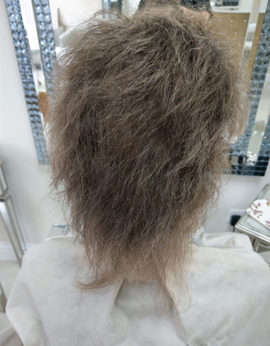 Hair InXs Womens Hair Loss Transformation Gallery Before