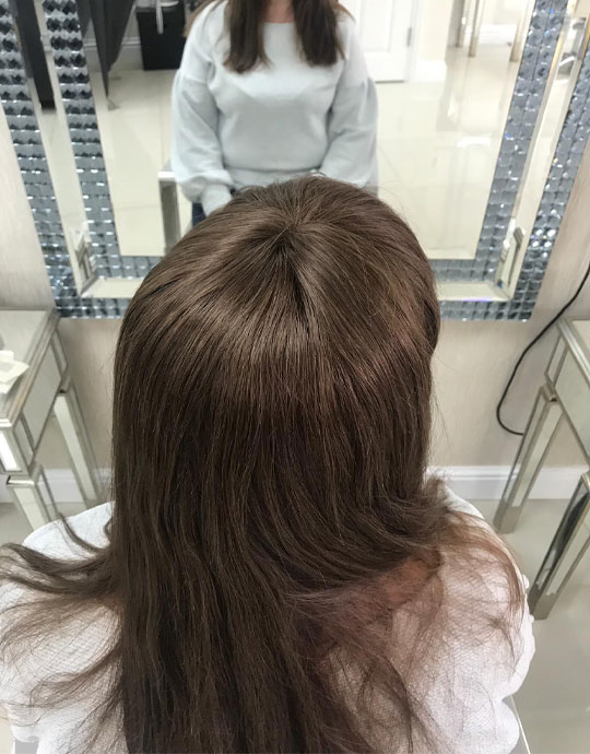 Hair InXs Womens Hair Loss Transformation Gallery After