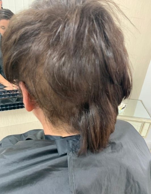 Hair InXs Womens Hair Loss Transformation Gallery Before