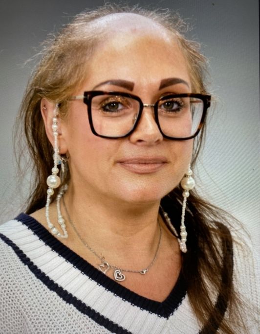 Hair InXs Womens Hair Loss Transformation Gallery Before