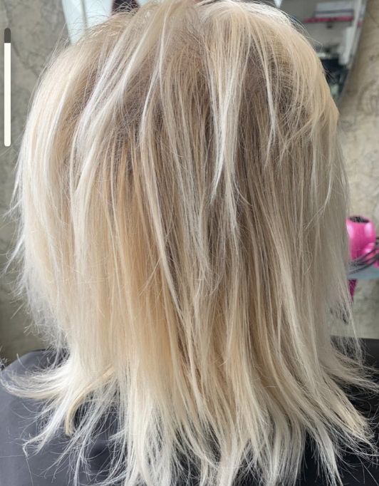 Hair InXs Womens Hair Loss Transformation Gallery Before