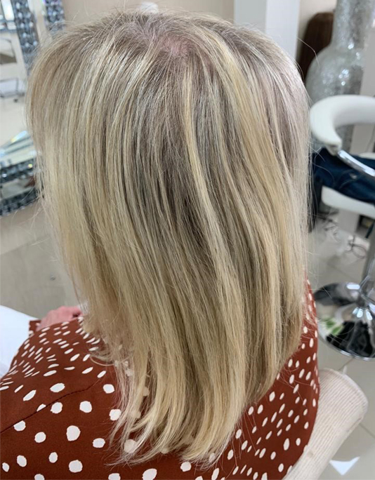 Hair InXs Womens Hair Loss Transformation Gallery Before