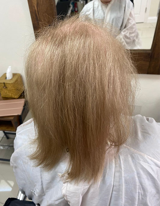 Hair InXs Womens Hair Loss Transformation Gallery Before