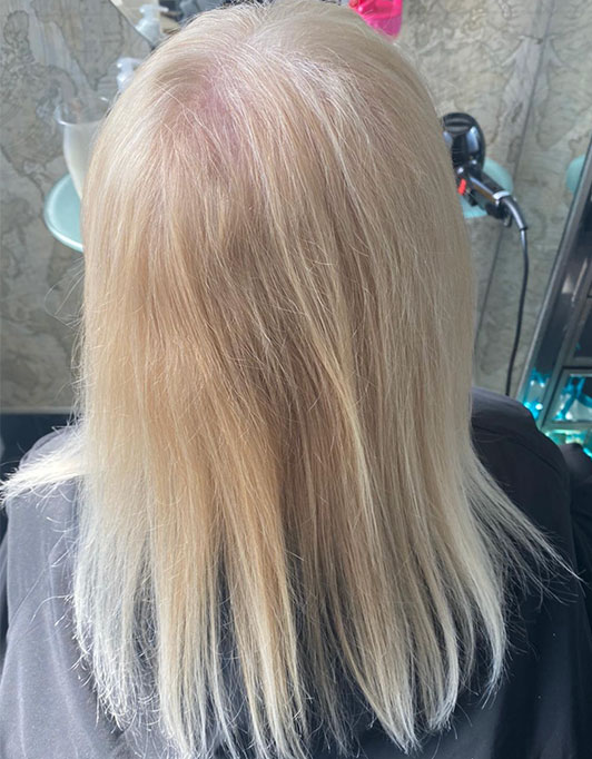 Hair InXs Womens Hair Loss Transformation Gallery Before