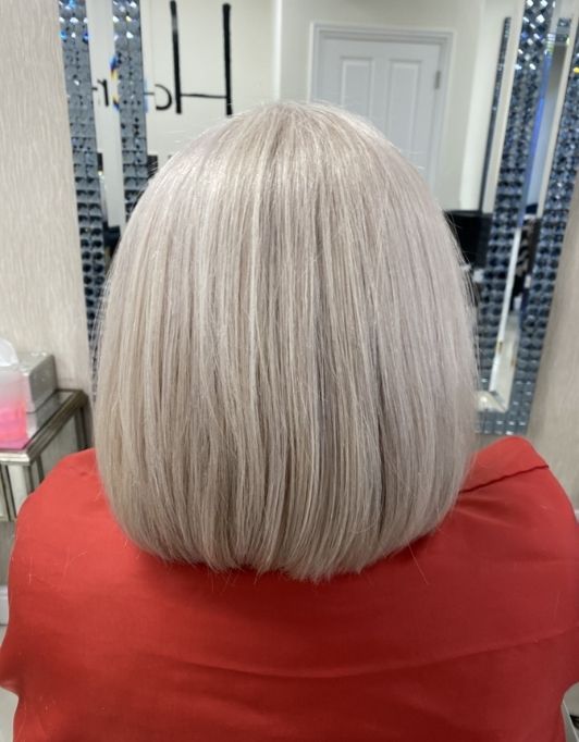 Hair InXs Womens Hair Loss Transformation Gallery After