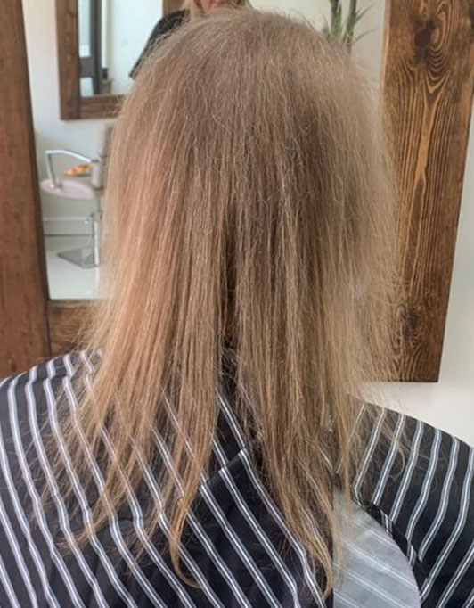Hair InXs Womens Hair Loss Transformation Gallery Before