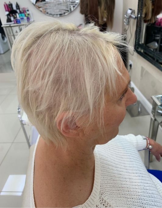 Hair InXs Womens Hair Loss Transformation Gallery Before