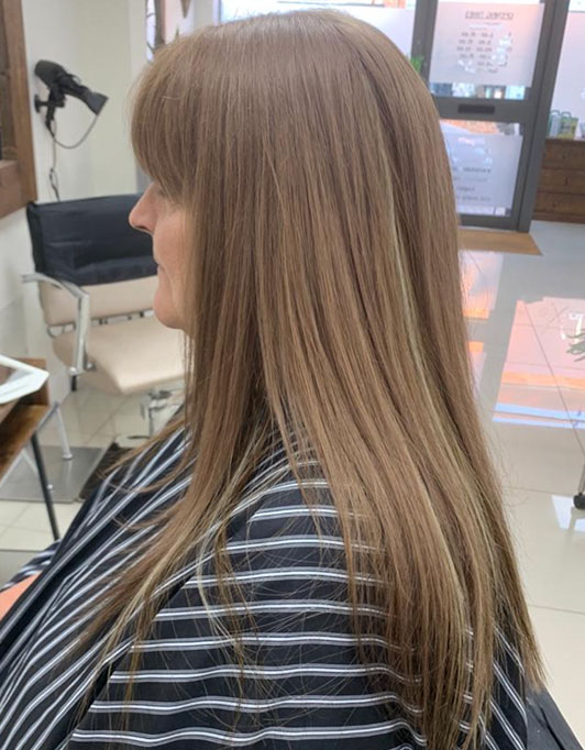 Hair InXs Womens Hair Loss Transformation Gallery Before