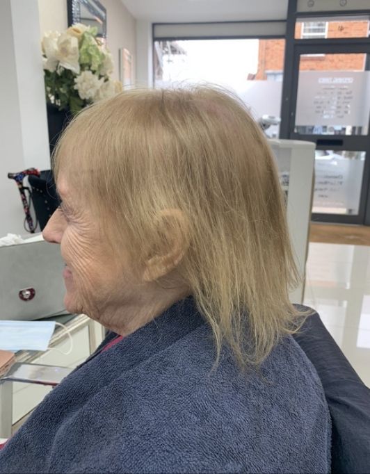 Hair InXs Womens Hair Loss Transformation Gallery Before