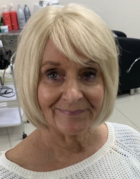 Hair InXs Womens Hair Loss Transformation Gallery After