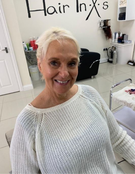 Hair InXs Womens Hair Loss Transformation Gallery Before