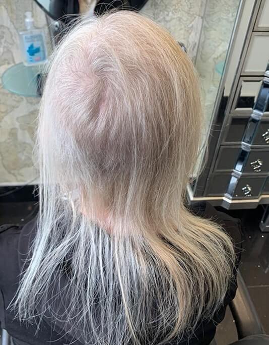 Hair InXs Womens Hair Loss Transformation Gallery Before