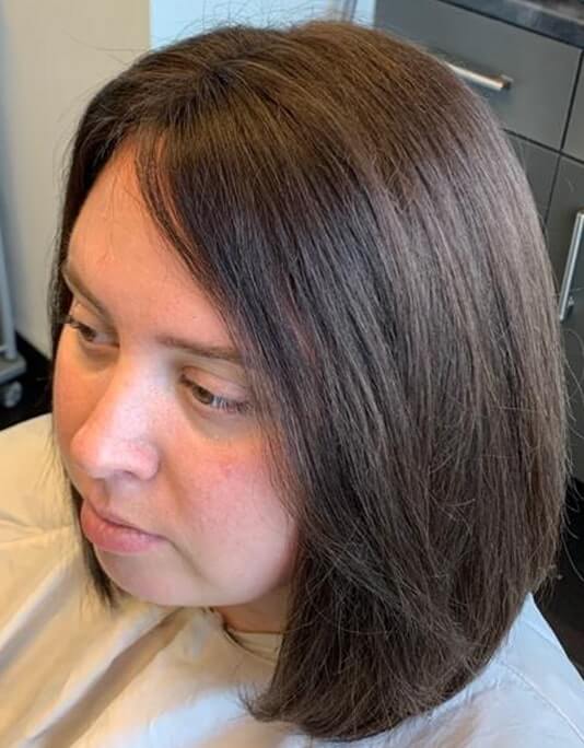 Hair InXs Womens Hair Loss Transformation Gallery After