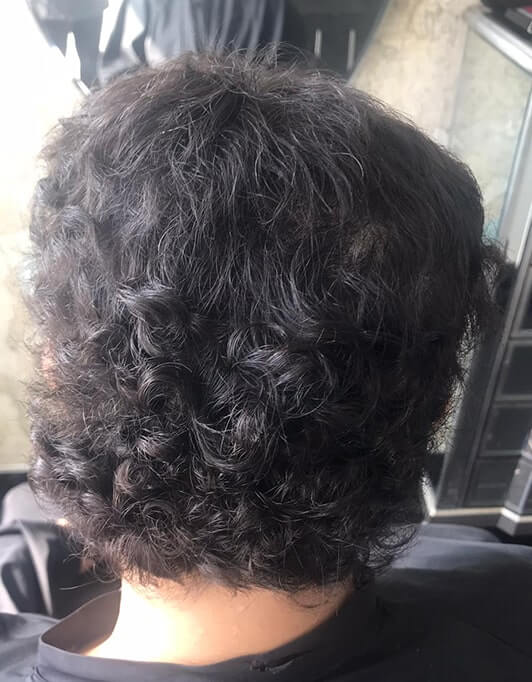Hair InXs Womens Hair Loss Transformation Gallery Before