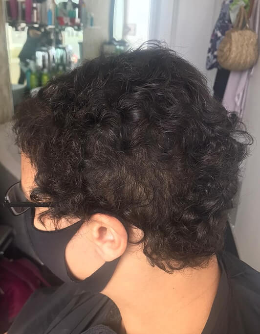 Hair InXs Womens Hair Loss Transformation Gallery Before