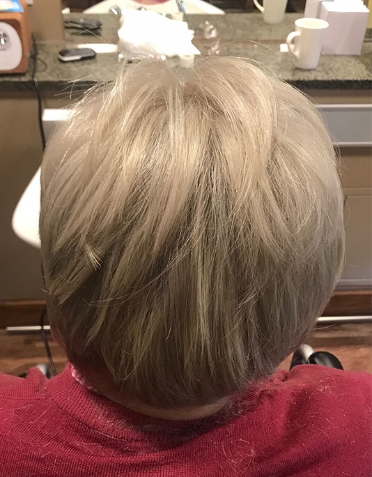 Hair InXs Womens Hair Loss Transformation Gallery After
