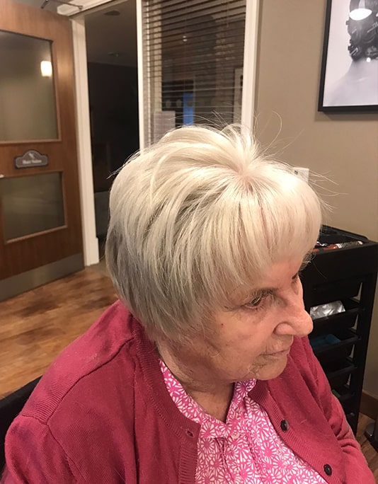 Hair InXs Womens Hair Loss Transformation Gallery After