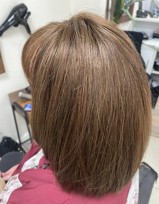 Hair InXs Womens Hair Loss Transformation Gallery After