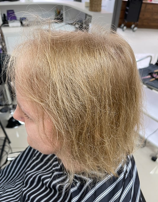 Hair InXs Womens Hair Loss Transformation Gallery Before