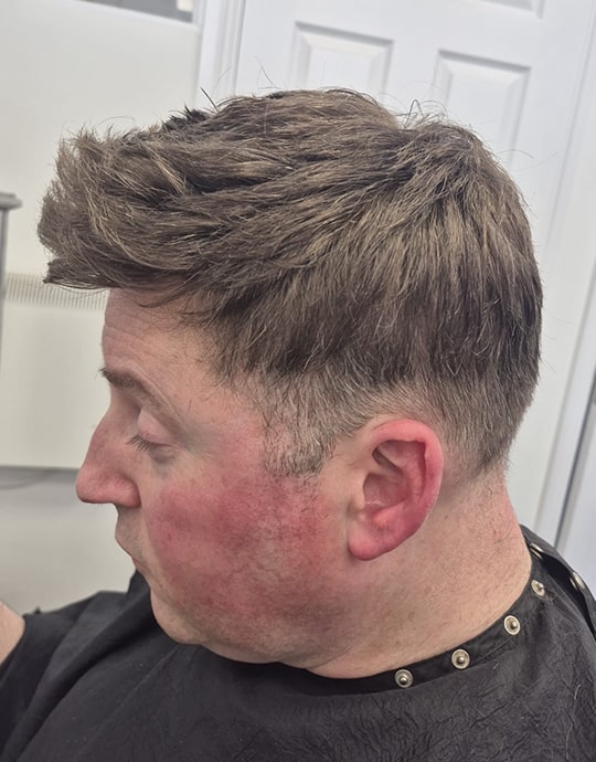 Hair InXs Mens Hair Loss Transformation Gallery After