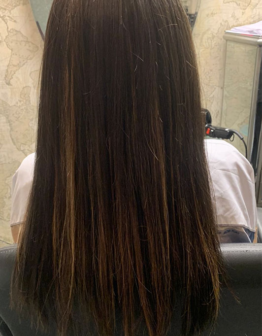 Hair InXs Womens Hair Loss Transformation Gallery After