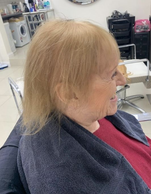Hair InXs Womens Hair Loss Transformation Gallery Before