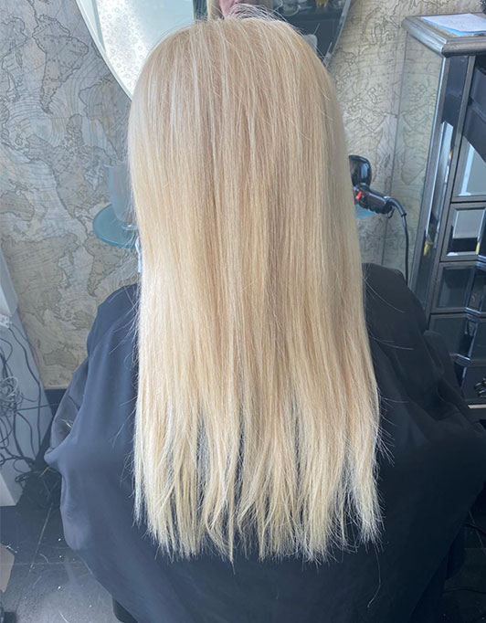 Hair InXs Womens Hair Loss Transformation Gallery Before