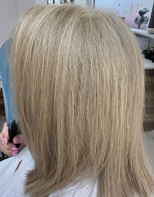 Hair InXs Womens Hair Loss Transformation Gallery After