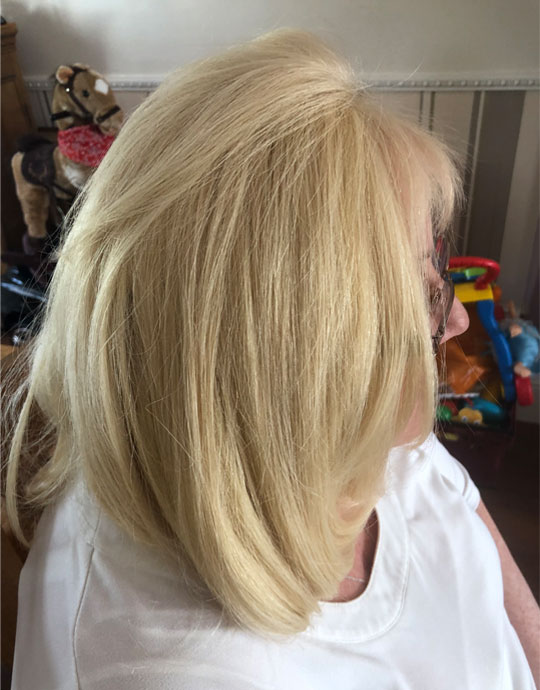 Hair InXs Womens Hair Loss Transformation After