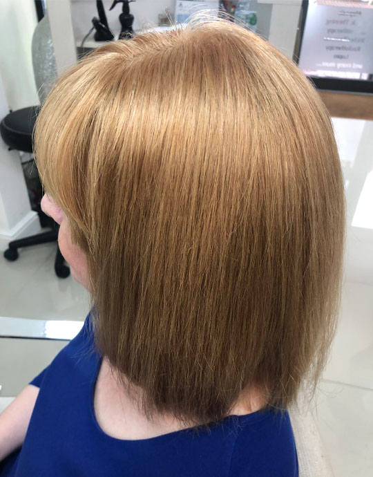 Hair InXs Womens Hair Loss Gallery After