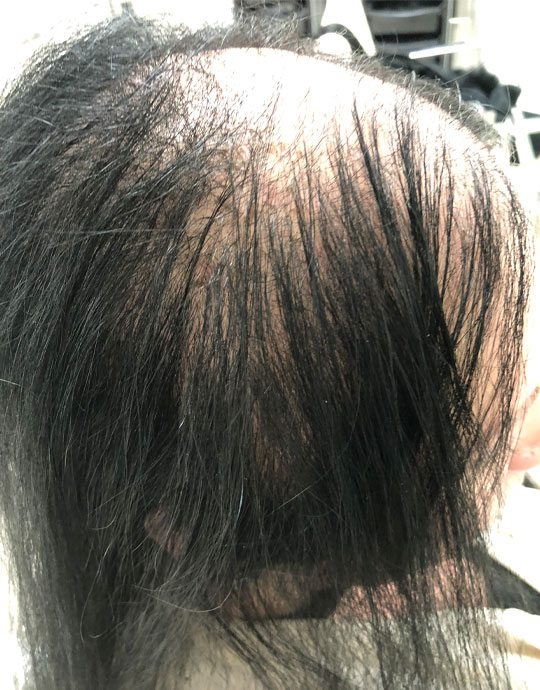 Hair InXs Transformation Gallery Before