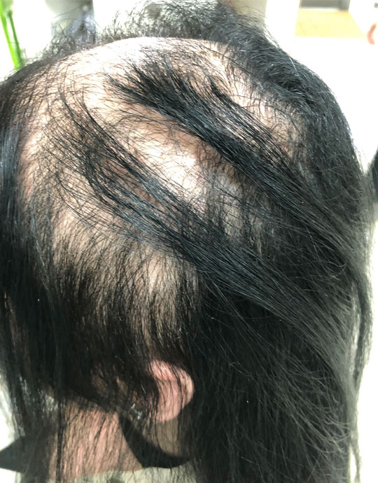 Hair InXs Transformation Gallery Before