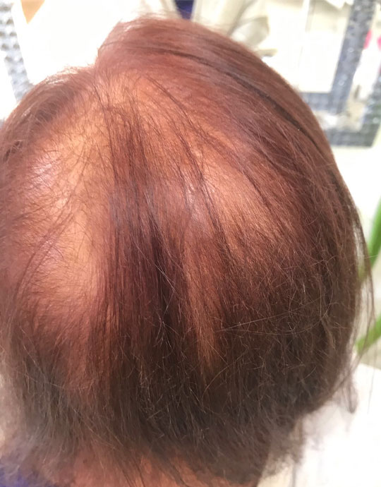 Hair InXs Transformation Before