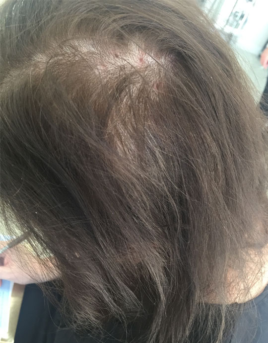Hair InXs Transformation Before
