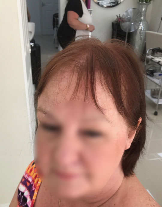 Hair InXs Transformation Before