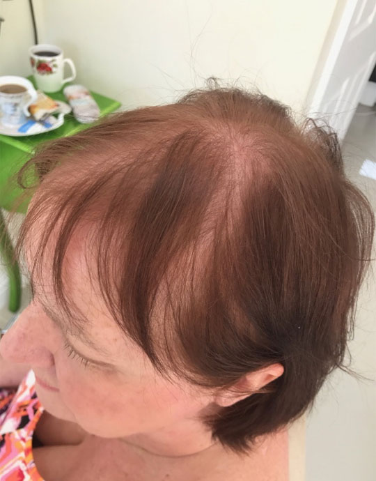 Hair InXs Transformation Before