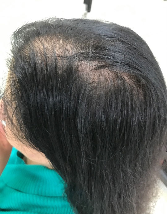 Hair InXs Transformation Before