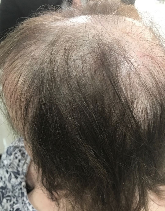 Hair InXs Transformation Gallery Before