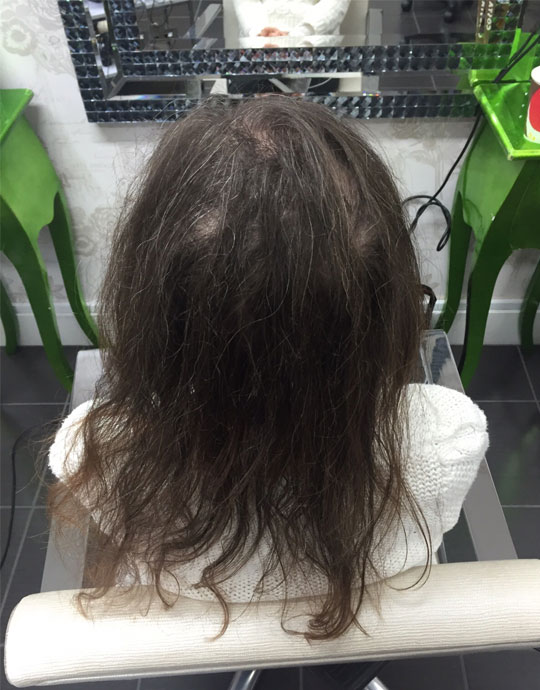 Hair InXs Transformation Gallery Before