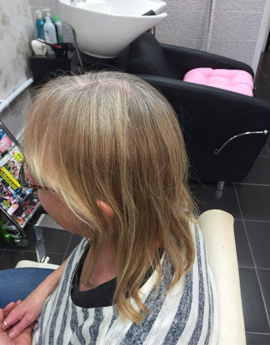 Hair InXs Womens Hair Loss Transformation Before