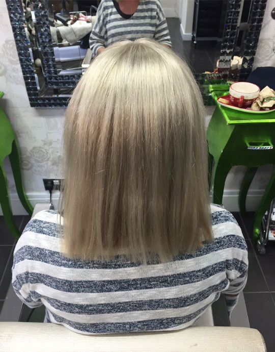 Hair InXs Womens Hair Loss Transformation After
