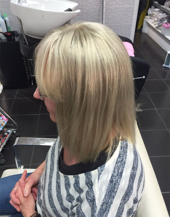 Hair InXs Womens Hair Loss Transformation After