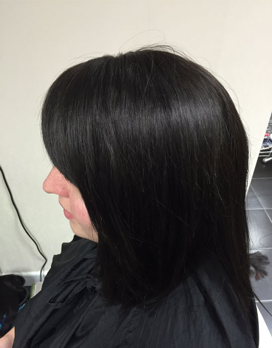 Hair InXs Womens Hair Loss Transformation After