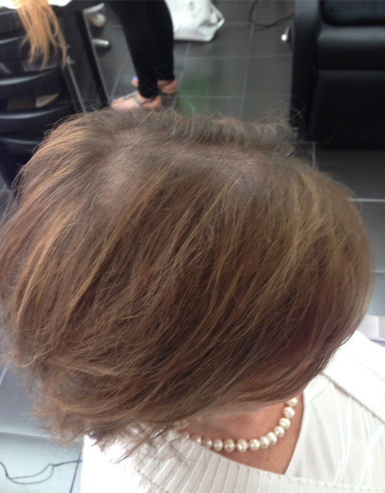 Hair InXs Womens Hair Loss Transformation Before