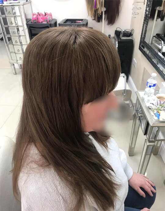 Hair InXs Womens Hair Loss Transformation Gallery After