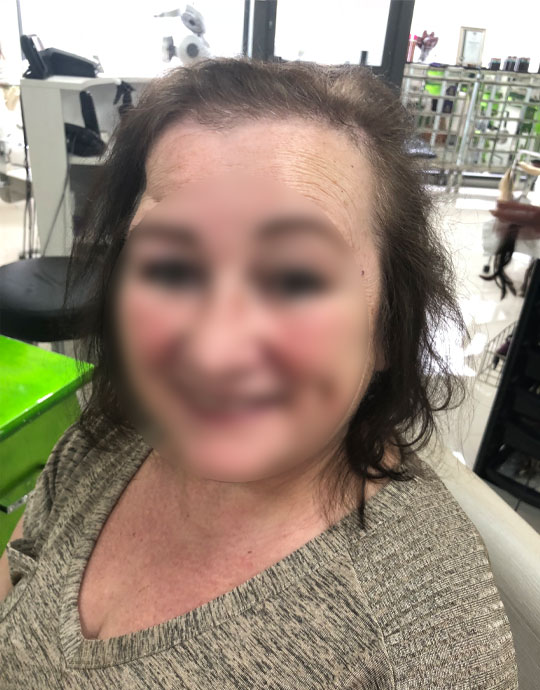 Hair InXs Transformation Before