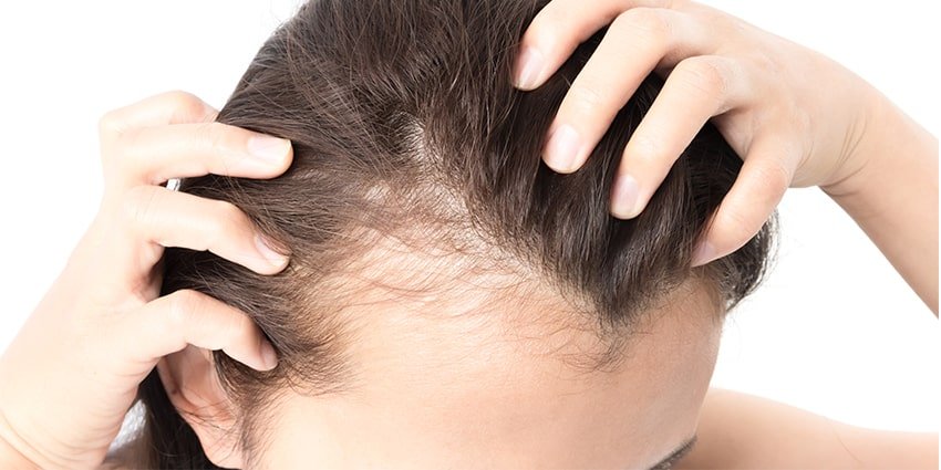 hair-loss-myths-min